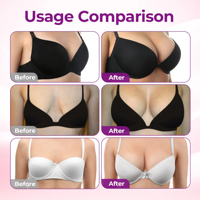 Alcuras Targeted Breast Enhancement Advanced Nano Microneedle Patch
